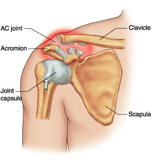 AC joint